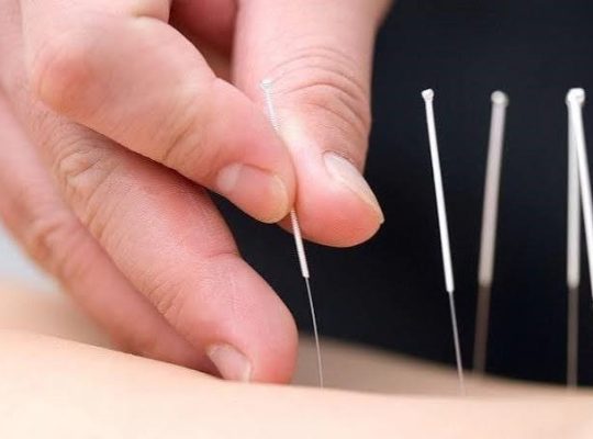 مطب تخصصی طب سوزنی و درد در منطقه شمال تهران و ونک