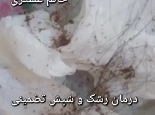 درمان شپش و رشک تضمینی و تخصصی