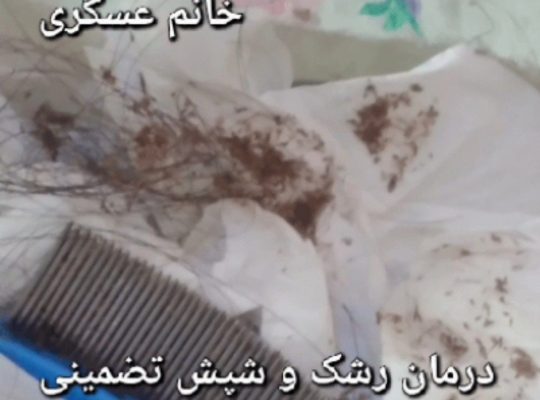 درمان شپش و رشک تضمینی و تخصصی