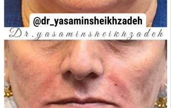بهترین پزشک زیبایی در خیابان پیروزی