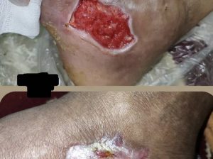 مرکز درمان زخم پاکدشت تهران